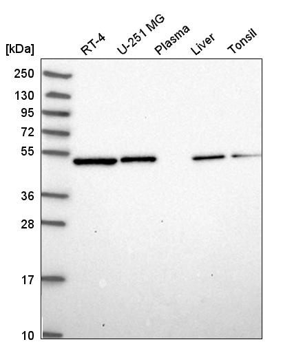 Anti-ILK Antibody