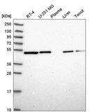 Anti-ILK Antibody