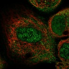 Immunofluorescent staining of human cell line A-431 shows localization to nucleoplasm, cytosol & cell junctions.
