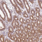 Anti-ARL2BP Antibody