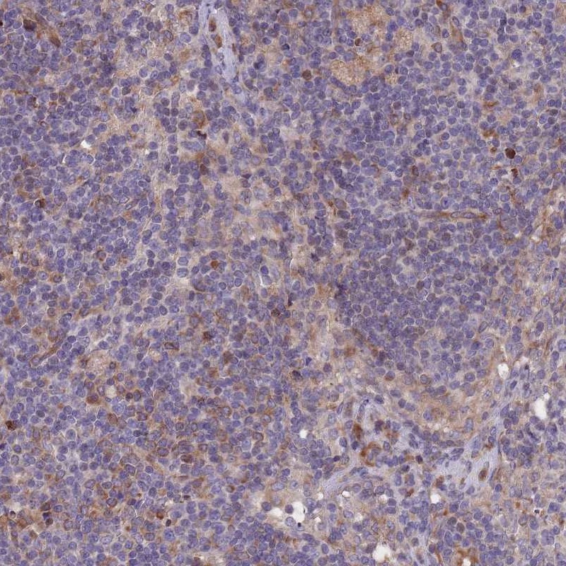 Anti-KIAA0922 Antibody