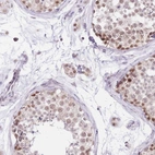 Immunohistochemical staining of human testis shows high expression.