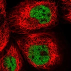 Immunofluorescent staining of human cell line A-431 shows localization to nucleoplasm.
