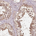Anti-KIAA1257 Antibody