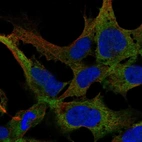 Immunofluorescent staining of human cell line AF22 shows localization to cytosol.