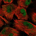 Immunofluorescent staining of human cell line U-251 MG shows localization to nucleoplasm, cytosol & centrosome.