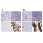 Immunohistochemical staining of human liver, lymph node, skeletal muscle and testis using Anti-LZTFL1 antibody HPA048447 (A) shows similar protein distribution across tissues to independent antibody HPA043466 (B).