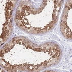 Immunohistochemical staining of human testis shows high expression.