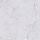 Immunohistochemical staining of human skeletal muscle shows low expression as expected.