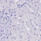 Anti-LZTFL1 Antibody