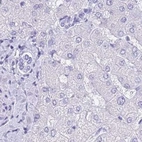Immunohistochemical staining of human liver using Anti-LZTFL1 antibody HPA048447.