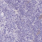 Immunohistochemical staining of human lymph node using Anti-LZTFL1 antibody HPA048447.