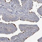 Anti-CCDC173 Antibody