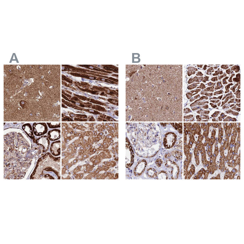 Anti-ATP5H Antibody