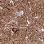 Immunohistochemical staining of human cerebral cortex using Anti-ATP5H antibody HPA048459.