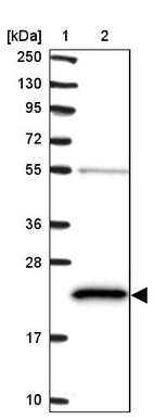 Lane 1: Marker [kDa] 250, 130, 95, 72, 55, 36, 28, 17, 10_br/_Lane 2: Human cell line RT-4