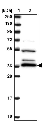 Lane 1: Marker [kDa] 250, 130, 95, 72, 55, 36, 28, 17, 10_br/_Lane 2: Human cell line RT-4