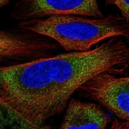 Immunofluorescent staining of human cell line U-2 OS shows localization to cytosol.