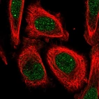 Immunofluorescent staining of human cell line PC-3 shows localization to nucleoplasm & nuclear bodies.