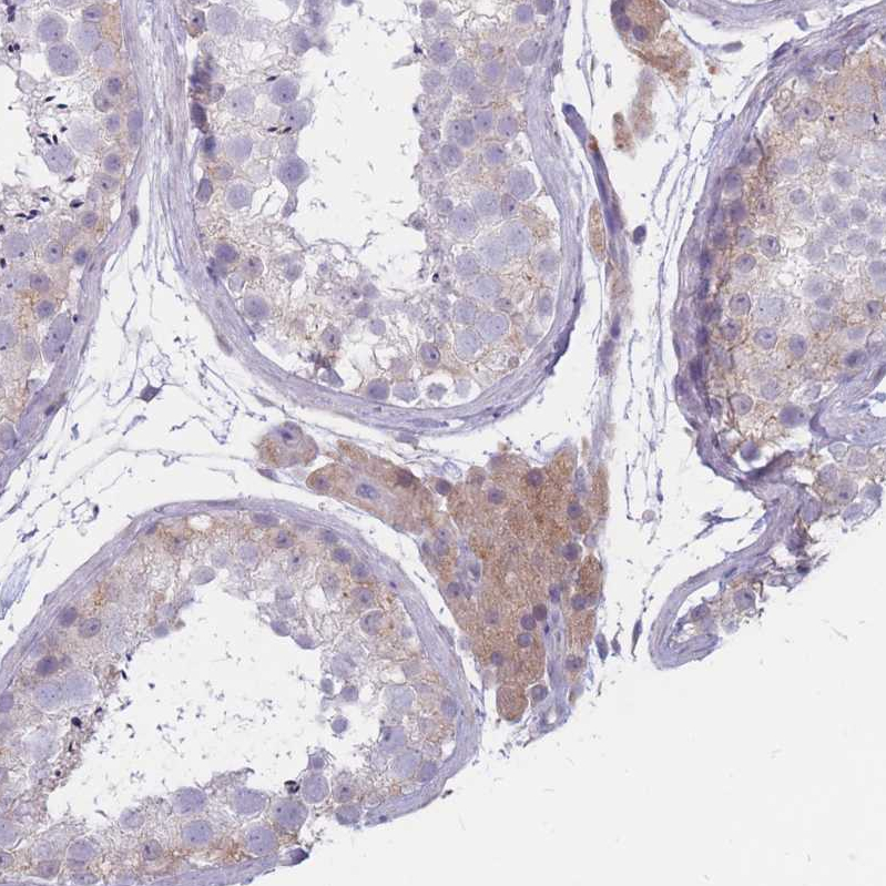 Anti-COL27A1 Antibody