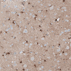 Anti-TMEM255A Antibody