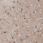 Anti-TMEM255A Antibody