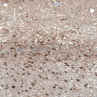 Immunohistochemical staining of human cerebellum shows strong cytoplasmic/membranous positivity in glial cells.