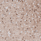 Immunohistochemical staining of mouse brain shows strong cytoplasmic / membranous positivity in glial cells.