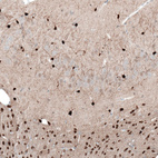 Immunohistochemical staining of rat brain shows strong cytoplasmic/ membranous positivity in glial cells.