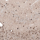 Immunohistochemical staining of rat brain shows strong cytoplasmic/ membranous positivity in glial cells.