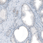 Immunohistochemical staining of human prostate shows very weak positivity in glandular cells as expected.