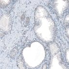 Immunohistochemical staining of human prostate shows very weak positivity in glandular cells as expected.