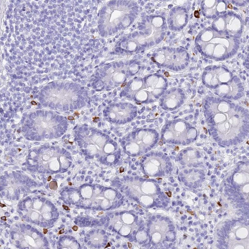 Anti-MYADML2 Antibody