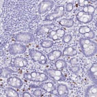 Anti-MYADML2 Antibody