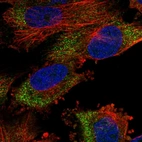 Immunofluorescent staining of human cell line U-251 MG shows localization to cytosol.