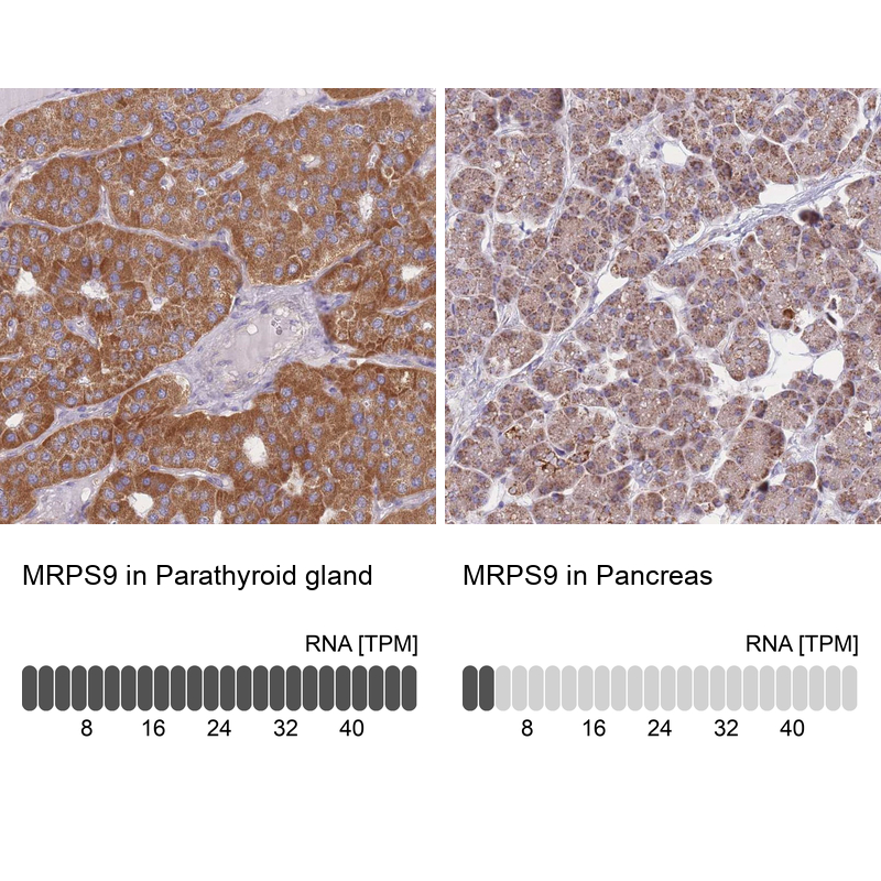 Anti-MRPS9 Antibody