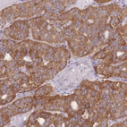 Immunohistochemical staining of human parathyroid gland shows high expression.