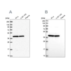 Western blot analysis using Anti-MRPS9 antibody HPA048479 (A) shows similar pattern to independent antibody HPA043476 (B).