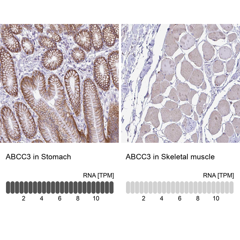 Anti-ABCC3 Antibody