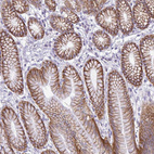 Immunohistochemical staining of human stomach shows strong membranous positivity in glandular cells.