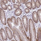 Immunohistochemical staining of human stomach shows strong membranous positivity in glandular cells.