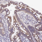 Immunohistochemical staining of human duodenum shows strong membranous positivity in glandular cells.
