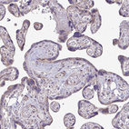 Immunohistochemical staining of human placenta shows moderate cytoplasmic positivity in trophoblastic cells.