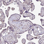 Immunohistochemical staining of human placenta shows moderate cytoplasmic positivity in trophoblastic cells.