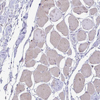 Immunohistochemical staining of human skeletal muscle shows no positivity in myocytes.