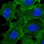 Immunofluorescent staining of human cell line A549 shows localization to plasma membrane.