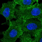 Immunofluorescent staining of human cell line A549 shows localization to plasma membrane.