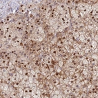 Anti-SYNDIG1L Antibody
