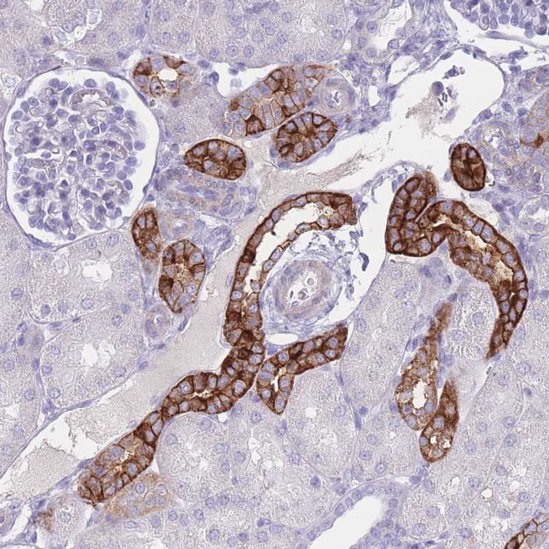 Anti-RHBG Antibody