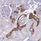 Anti-RHBG Antibody